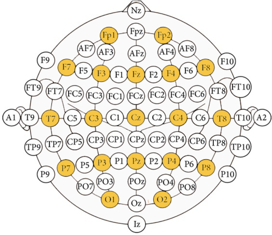 electrodes.png
