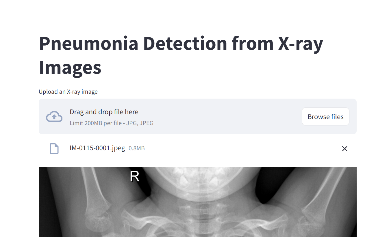 image1xray.png
