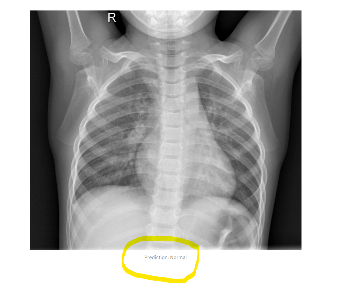 image2xray.png