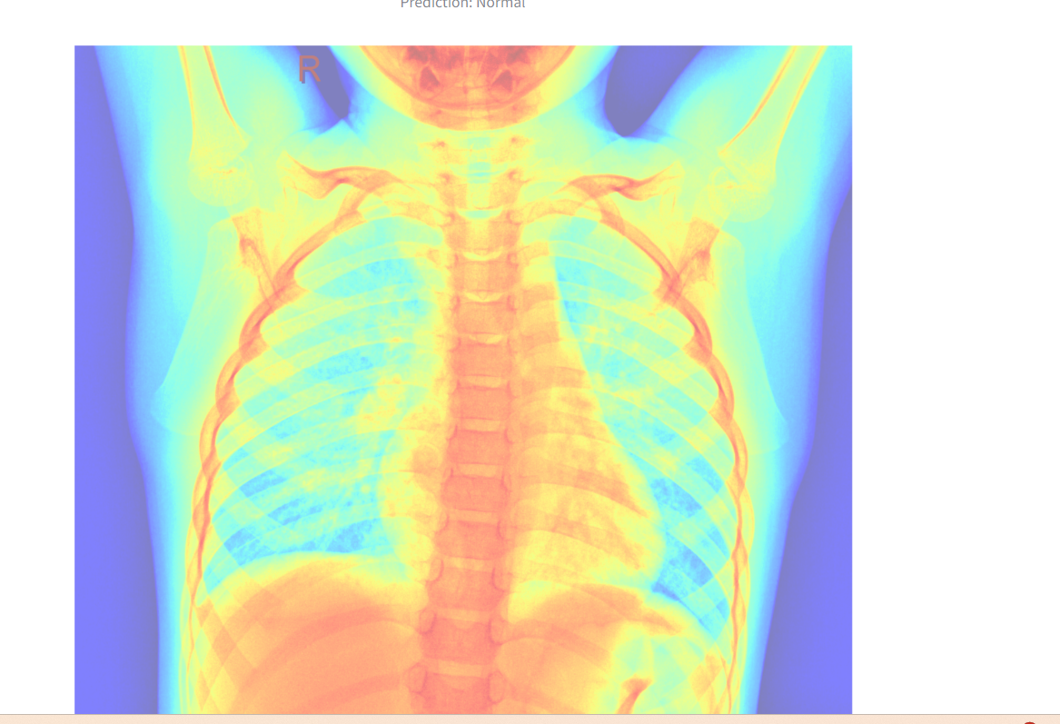 image3xray.png