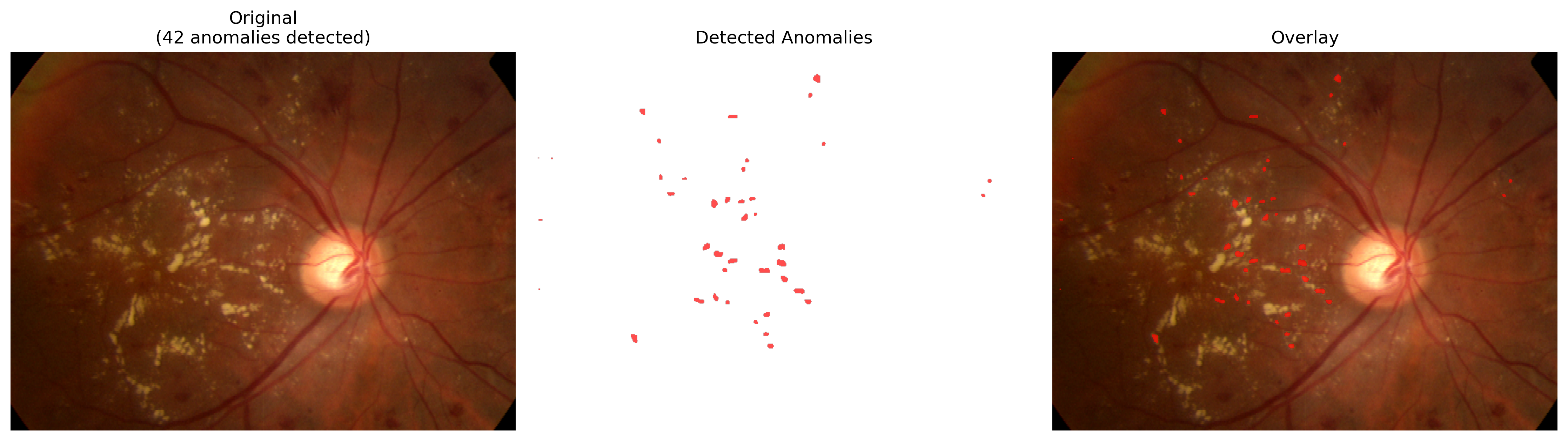 anomaly_detection_20241228_010601.png
