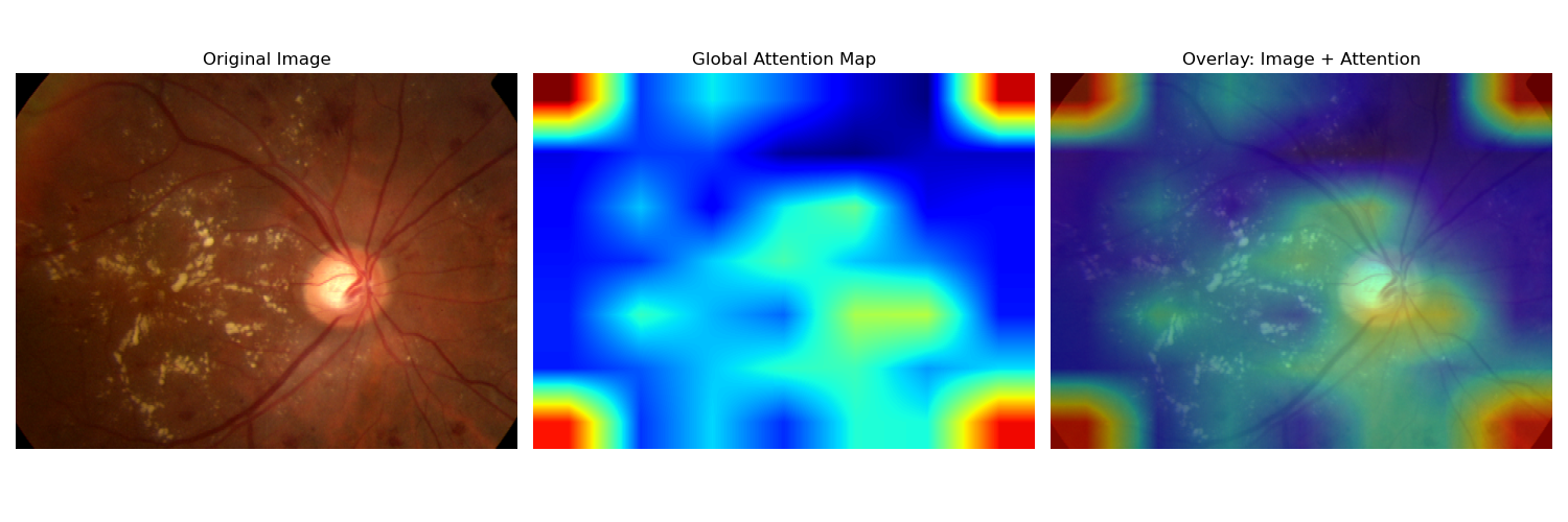 global_attention.png